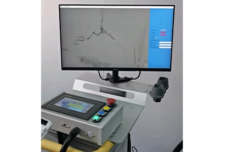 硅胶外周血管的数字减影血管造影 (DSA)