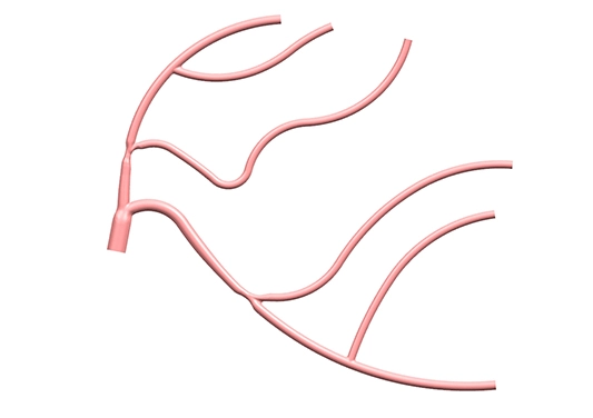 Drawing of Planar Left Coronary Vessel Model (Radial Artery Approach)