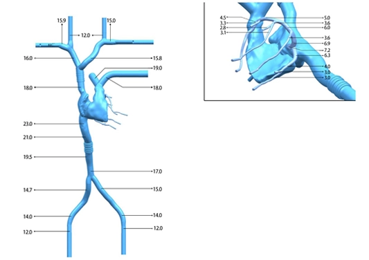 Drawing of Cardiac Veins Simulation Model