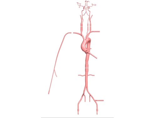 Drawing of Intracranial Vascular Model