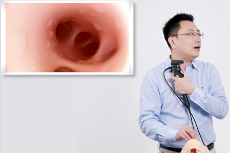 支气管镜基础操作讲解