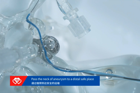 心玮医疗神经血管介入模型