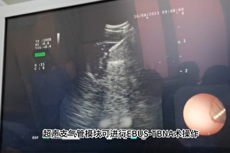 超声支气管镜介入训练模型（EBUS-TBNA）
