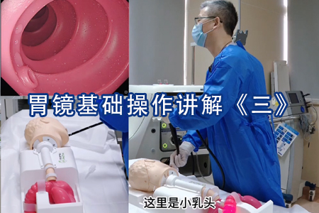 胃镜基础操作讲解《三》