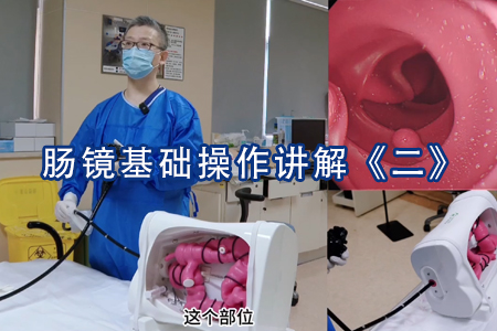 结肠镜基础操作讲解《二》