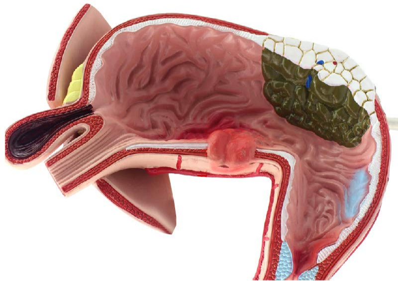 胃.png