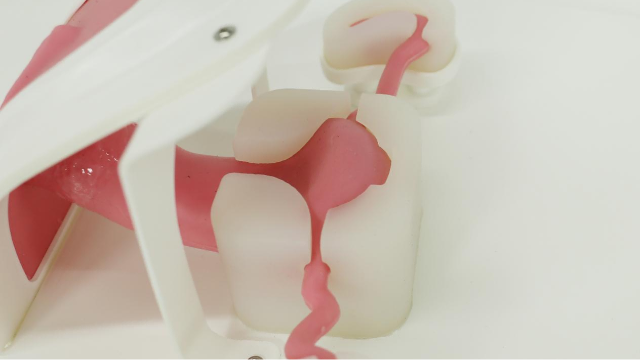 宫腔模型1.png