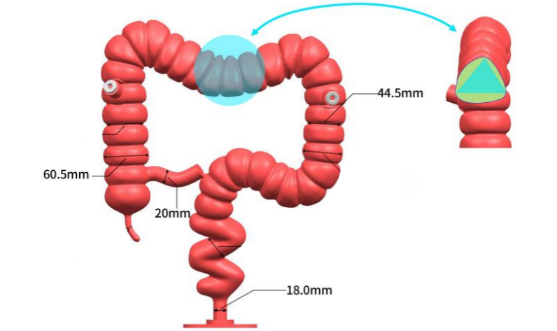 结肠模型.png
