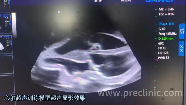 心脏超声训练模型超声显影效果.png