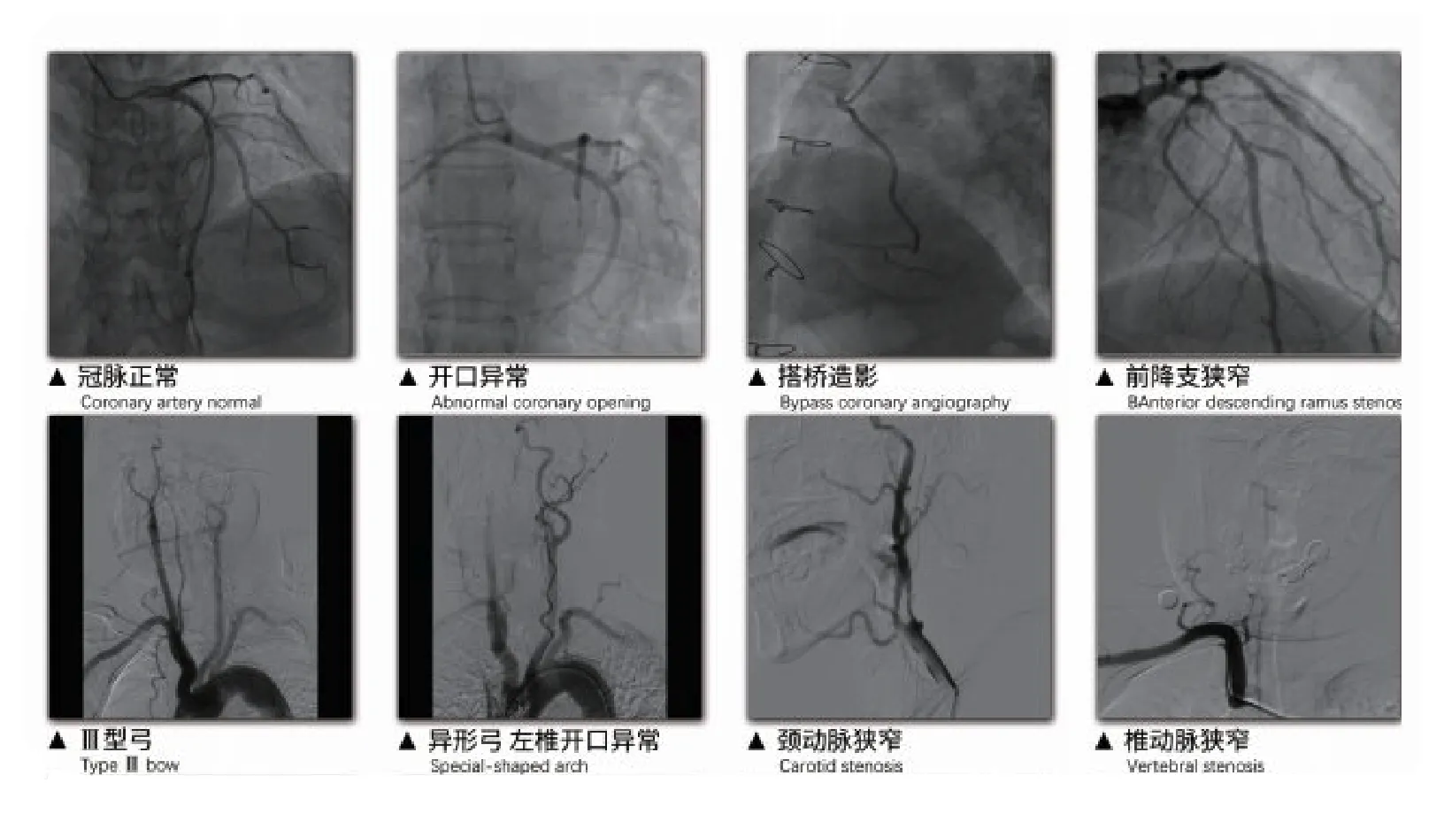 涵盖多项心脑血管介入培训模块