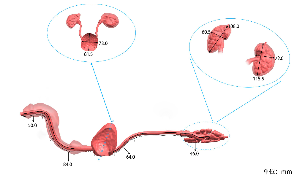 泌尿内镜训练模型三维设计图.png 泌尿内镜训练模型三维设计图.png