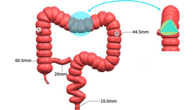 璞临结肠模型三维图.png