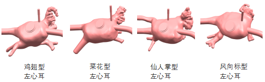 璞临医疗左心耳仿真模型四种模块.png