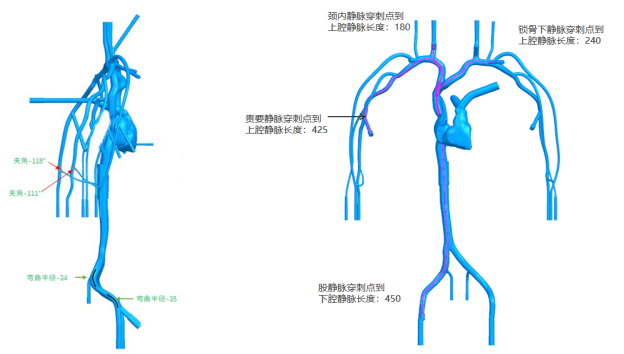 璞临医疗PICC训练模型产品设计图.png 璞临医疗PICC训练模型产品设计图.png