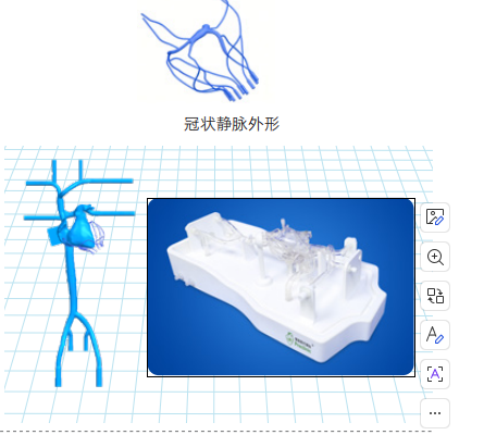 冠状静脉介入训练模型.png